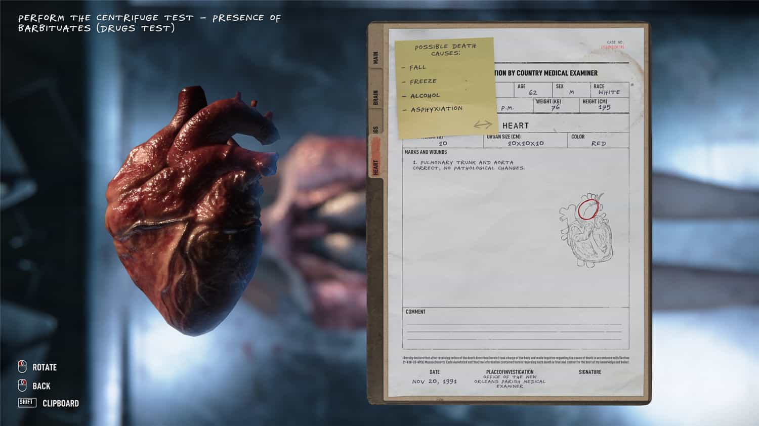 验尸模拟器/Autopsy Simulator 更新至v153.413-容量20.3GB插图2